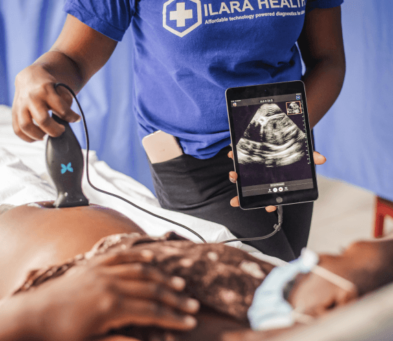 using butterfly device